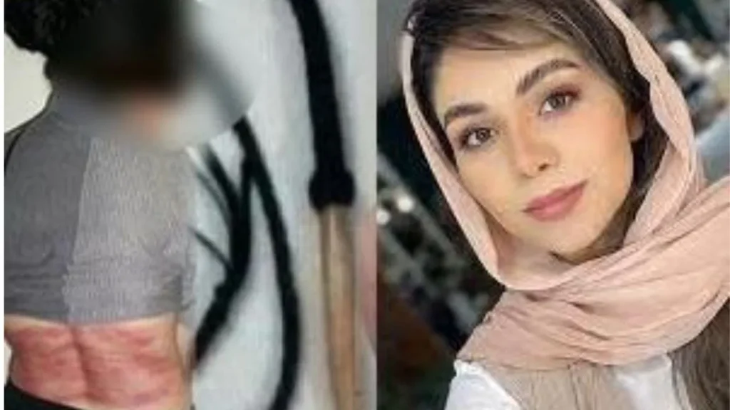 All women in Iran have been required by law to cover their neck and head since shortly after the 1979 Islamic Revolution.