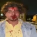 Indian student attacked in Chicago, Consulate providing assistance
