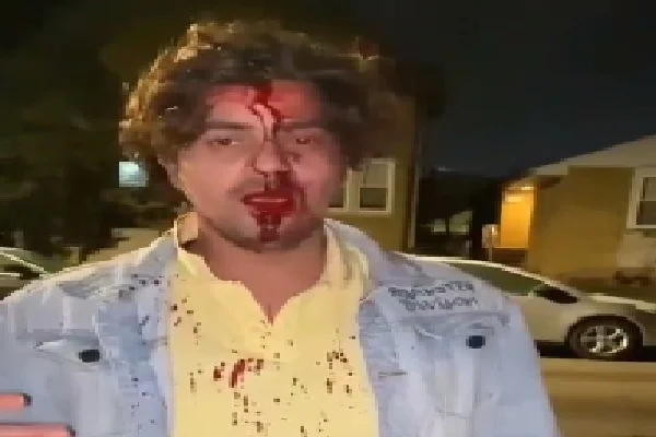 Indian student attacked in Chicago, Consulate providing assistance